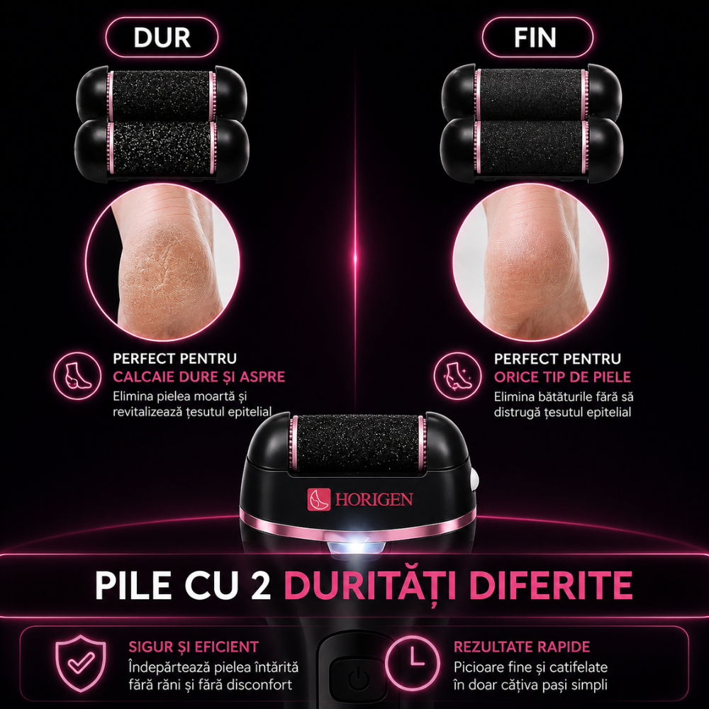 Set Pila Electrica Horigen V-605 Pentru Talpi Si Calcaie