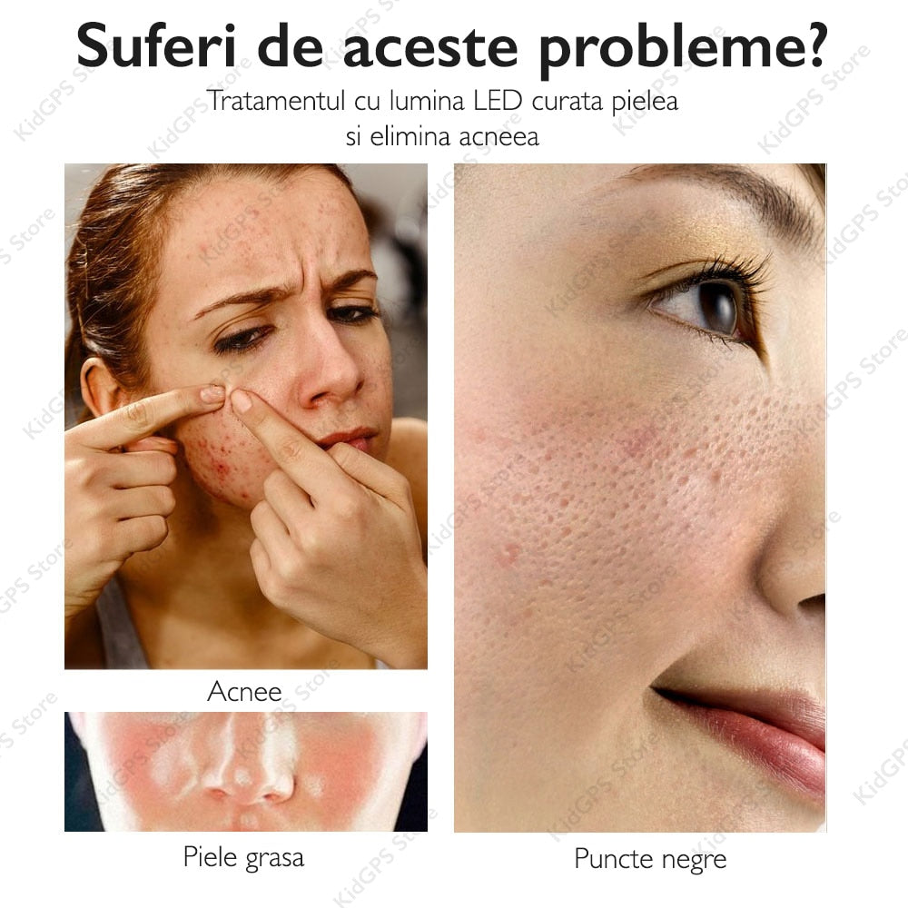 Aparat pentru ingrijire faciala 5 in 1 Horigen™ W-618