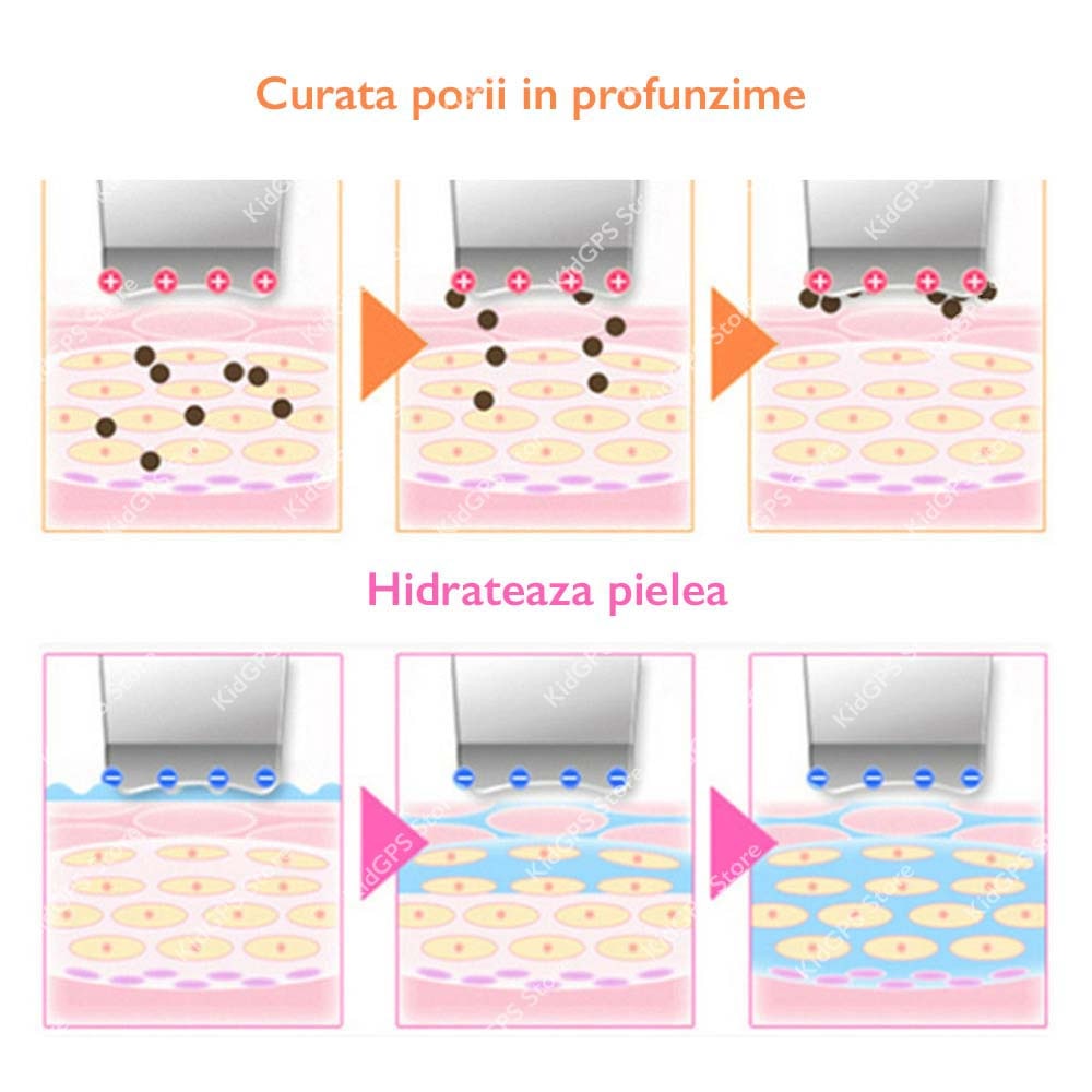 Aparat de curatare faciala cu ultrasunete Horigen® Fem Skin Pro