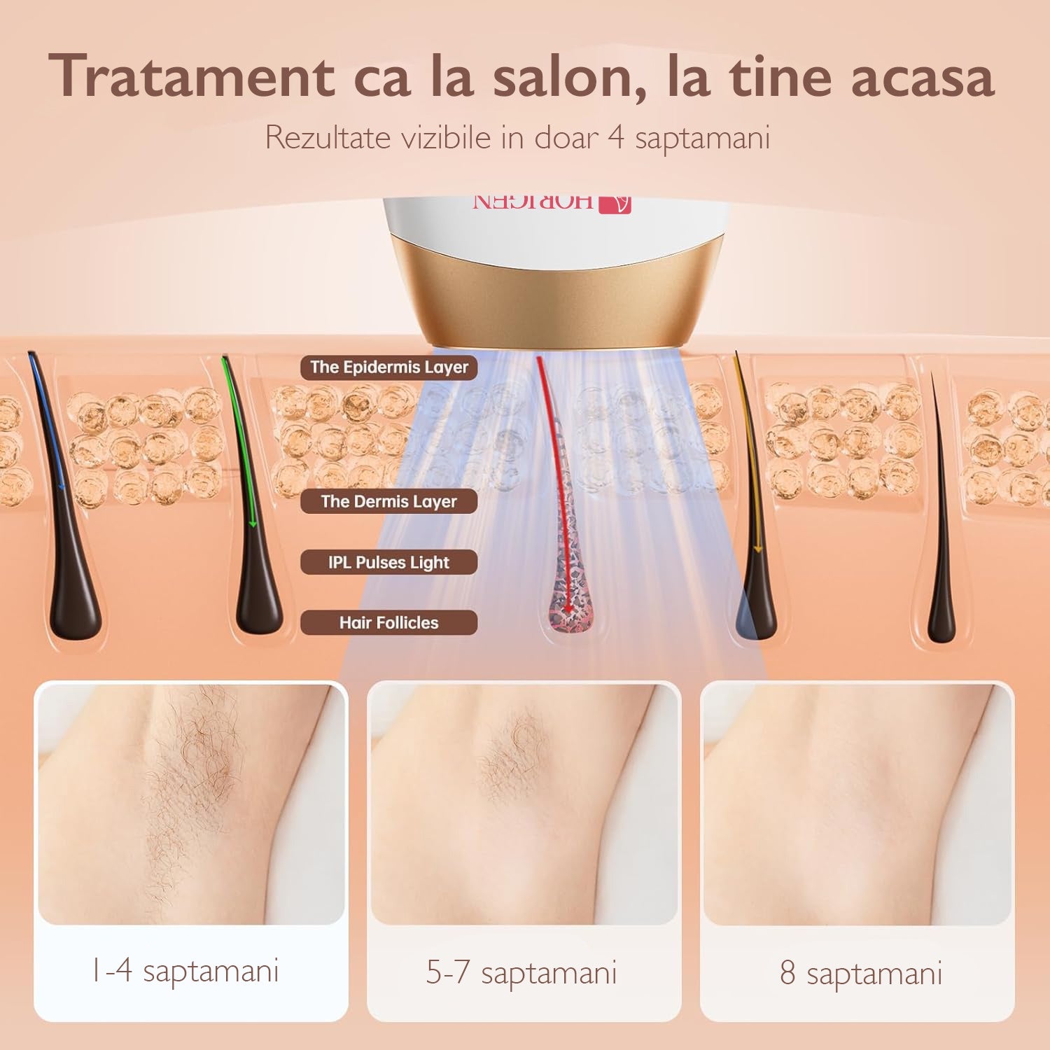 Epilator IPL Horigen® LumiCare Perfection, Alb