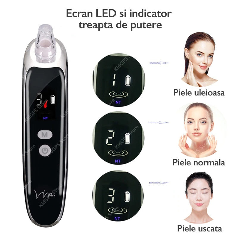 Aparat electric pentru scos puncte negre, Horigen™ JH109