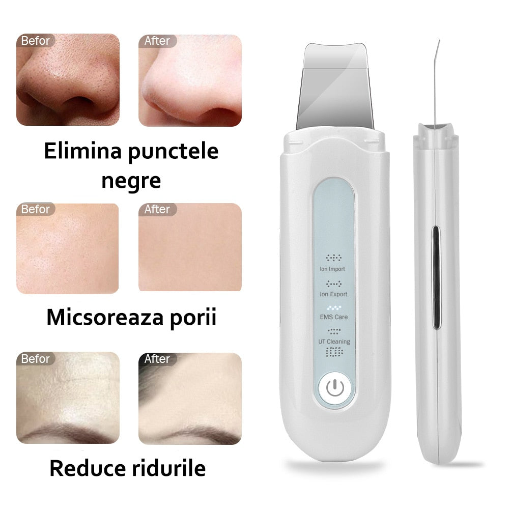 Aparat de curatare faciala cu ultrasunete, Horigen™ Ultrasonic Cleaner