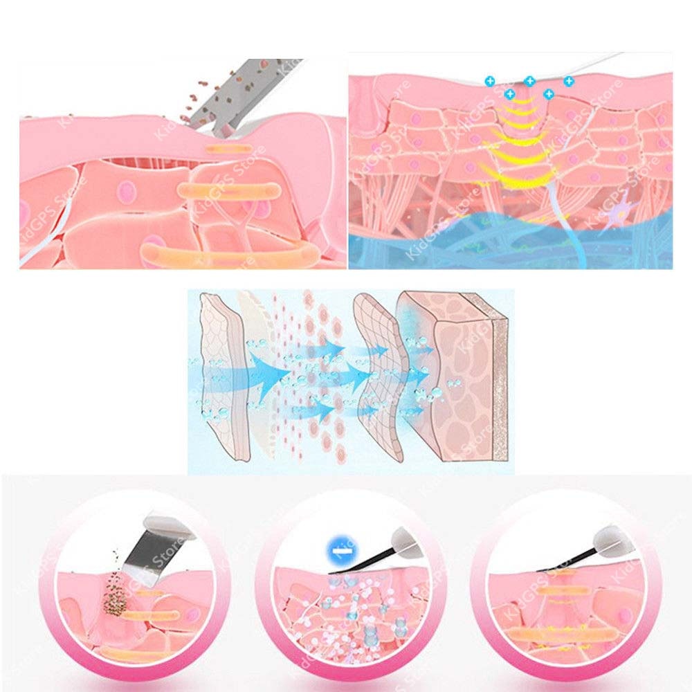 Aparat de curatare faciala cu ultrasunete Horigen® Fem Skin Pro