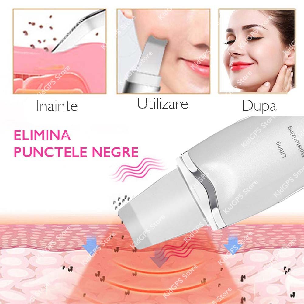 Aparat de curatare faciala cu ultrasunete Horigen® Fem Skin Pro