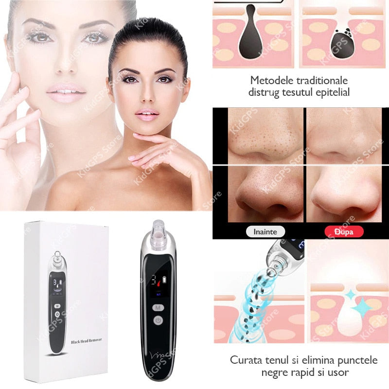 Aparat electric pentru scos puncte negre, Horigen™ JH109