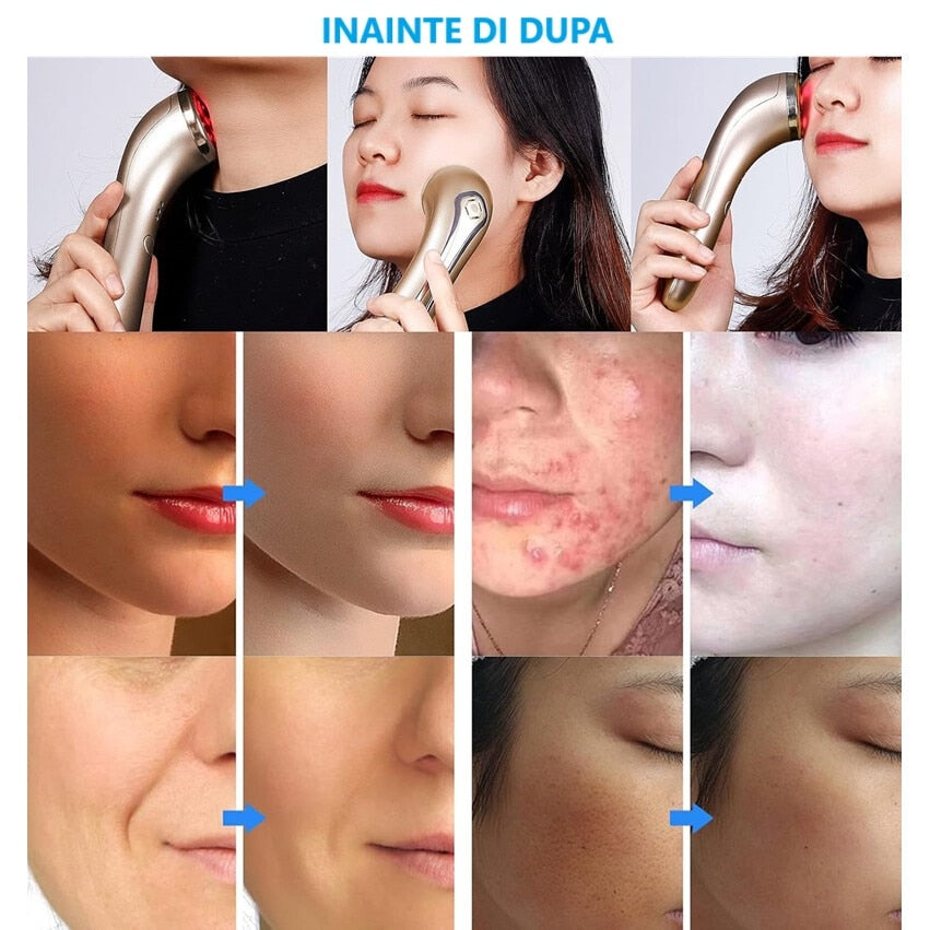 Dispozitiv pentru intretinere faciala cu infrarosu si caldura Horigen® BP-1803 Pro