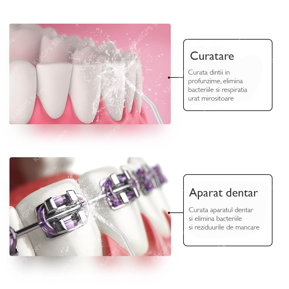 Irigator bucal si oral profesional Horigen® V1